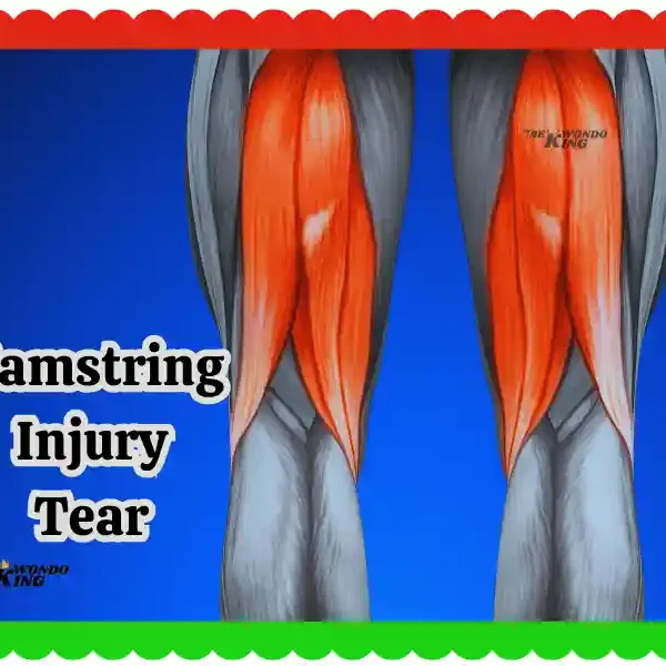 Hamstring Injury Tear: Causes, Treatment & Recovery New Free Hack, taekwondoking