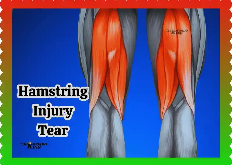 Hamstring Injury Tear: Causes, Treatment & Recovery New Free Hack, taekwondoking