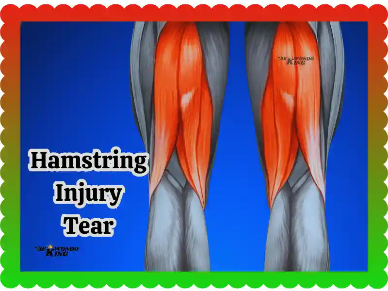 Hamstring Injury Tear: Causes, Treatment & Recovery New Free Hack, taekwondoking