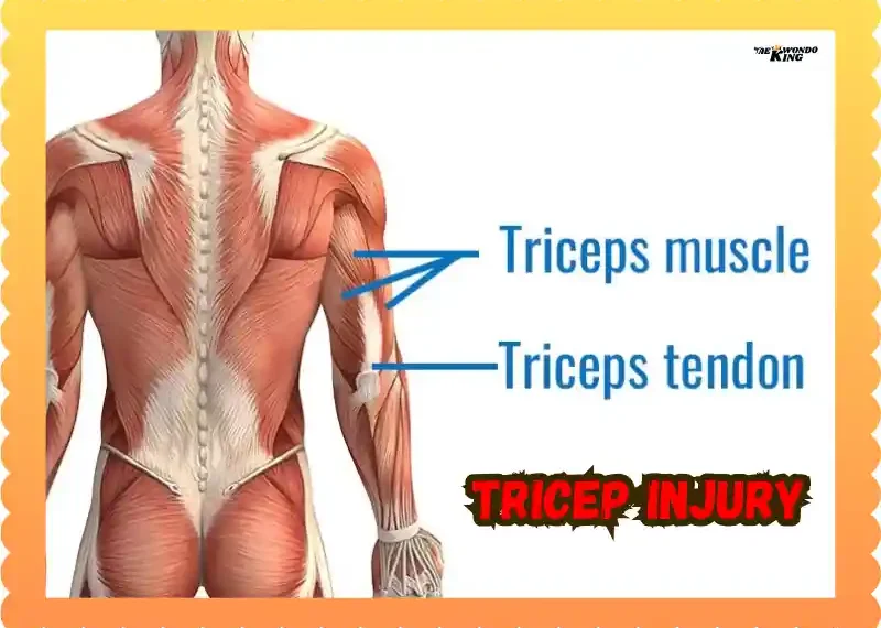 Tricep Injury: Spot It, Treat It, Prevent It, taekwondoking