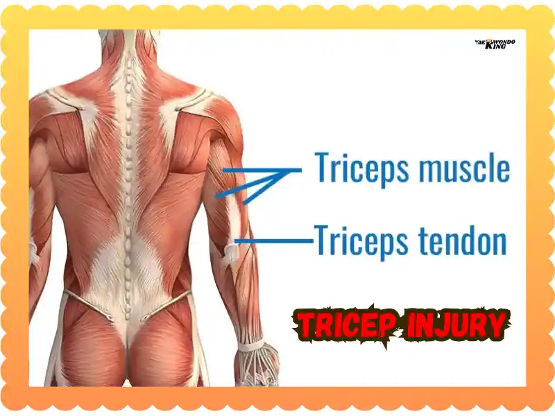 Tricep Injury: Spot It, Treat It, Prevent It, taekwondoking